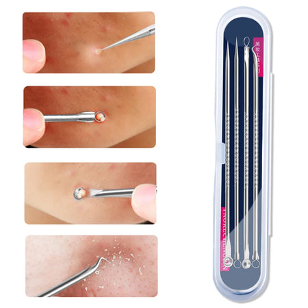 Pimple & Blackhead Extractor